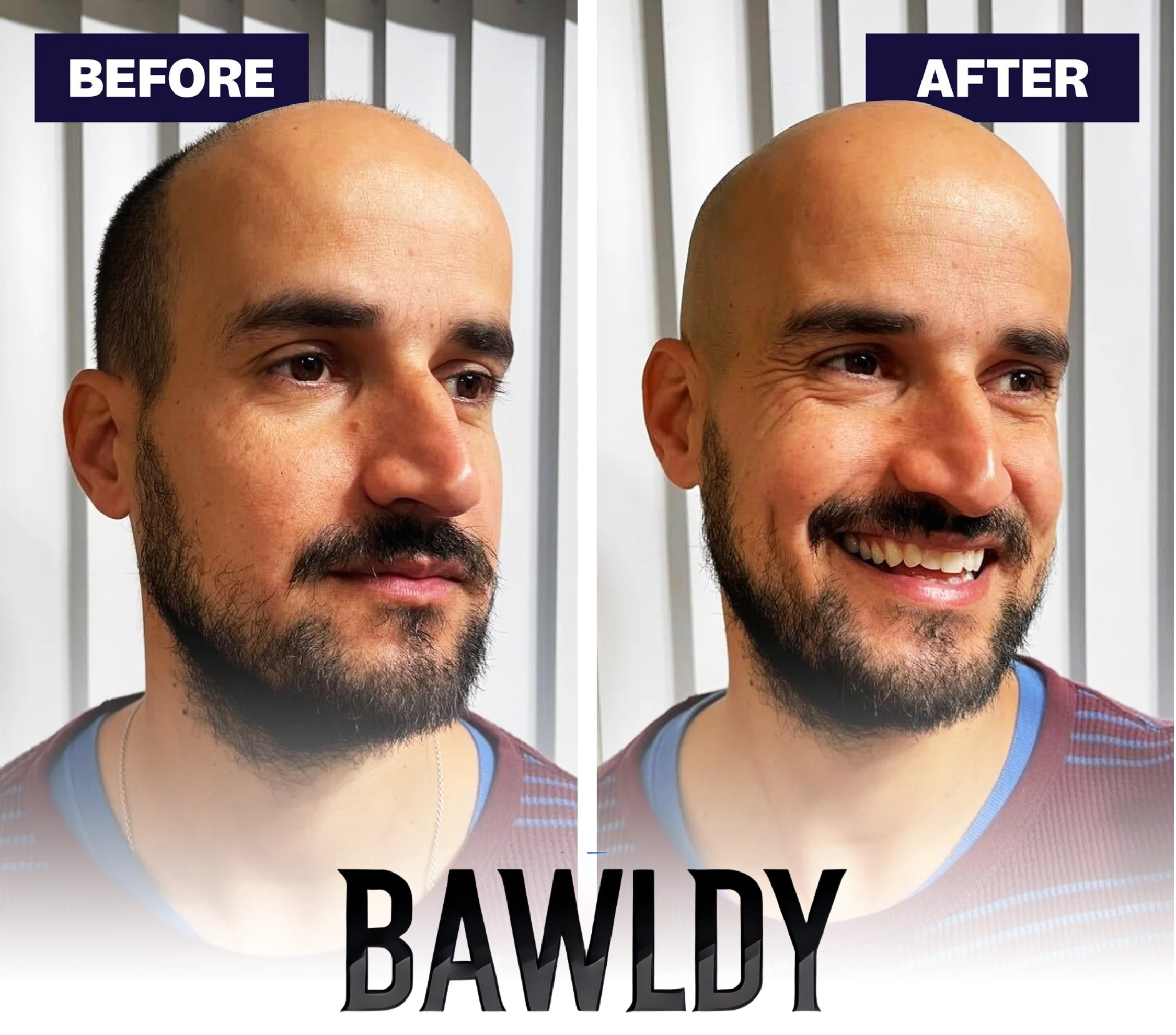 BAWLDY™ 9.0 ULTRA